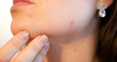 Acne Feature Image