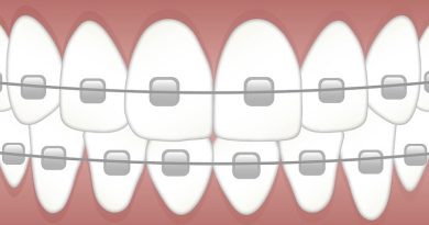 Braces Clip Art Types of Braces