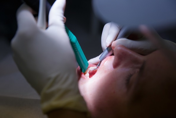 Woman in Dental Chair - Do your teeth need replacing?
