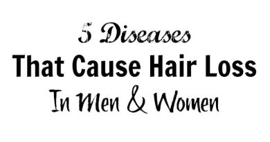 Hair Loss