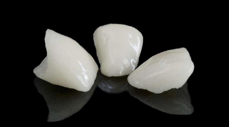 Teeth - Oral Implants