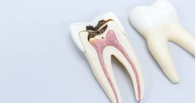 Sectioned Tooth - Tooth Replacements