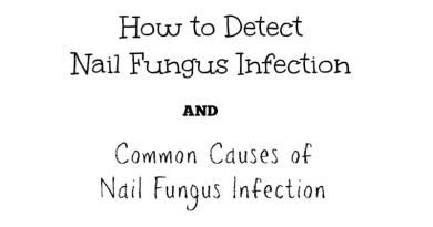 Nail Fungus Text -