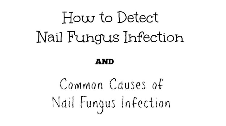 Nail Fungus Text -