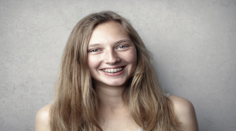 Smiling woman with braces on her teeth - Who would benefit from invisible braces?