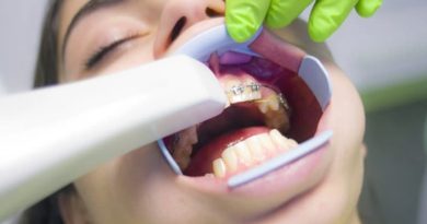 Patient in chair having teeth whitened - Teeth Whitening