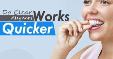 Do Quick Aligners Work Quicker