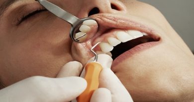 Dental Patient with open mouth