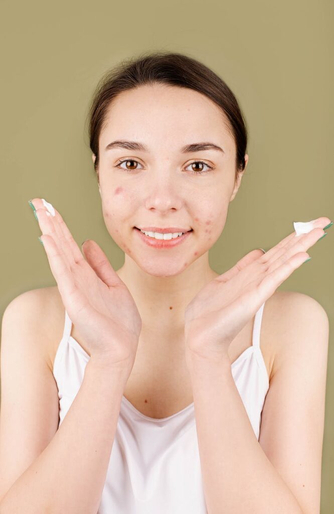 Woman with dark hair and skin blemishes with hands out with lotion on them.