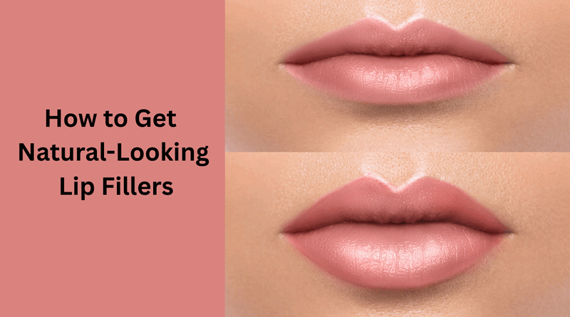 How to Get Natural Looking Lip Fillers